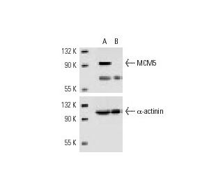 MCM5 siRNA (h): sc-35883. Western blot analysis of MCM5 expression in non-transfected control (A) and MCM5 siRNA transfect 