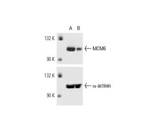 MCM6 siRNA (h): sc-35885. Western blot analysis of MCM6 expression in non-transfected control (A) and MCM6 siRNA transfect 