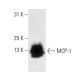 MCP-1 Antibody (5J) - Western Blotting - Image 10476 