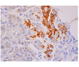 MCP-4 Antibody (D-2) - Immunohistochemistry - Image 284845 