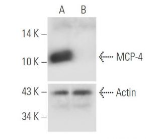 MCP-4 shRNA Plasmid (h): sc-72122-SH. Western blot analysis of human MCP-4 expression in MCP-4 transfected (A) and MCP-4/M 