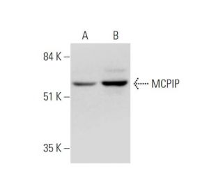 MCPIP Antibody (H-6) - Western Blotting - Image 344519SAM Transcription Activation: SAM system utilizing dCas9-VP64, MS2-P65-HSF1, and sgRNA for precise gene transcription activation.