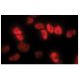 MCPyV large T-antigen Antibody (CM2B4) - Immunofluorescence - Image 156450