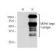 MCPyV large T-antigen Antibody (CM2B4) - Western Blotting - Image 156451 