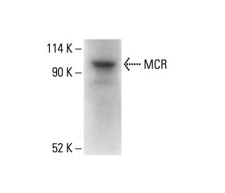 MCR Antibody (4i342) - Western Blotting - Image 411924Each CRISPR/Cas9 Knockout (KO) Plasmid product consists of a pool of 3 plasmids designed to ensure identification and cleavage of a specific gene for maximum knockout efficiency. Each plasmid encodes a unique 20 nt sequence derived from the GeCKO (v2) library. 