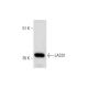 LASS1 (H-170): sc-135033. Western blot analysis of LASS1 expression in MDA-MB-231 whole cell lysate. 