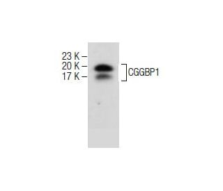MDA-MB-435S Whole Cell Lysate: sc-364184. Western blot analysis of CGGBP1... 