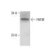 MDA-MB-435S Whole Cell Lysate: sc-364184. Western blot analysis of HVEM...