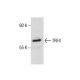 TRF4 (P-17): sc-107307. Western blot analysis of TRF4 expression in MDA-MB-468 whole cell lysate. 