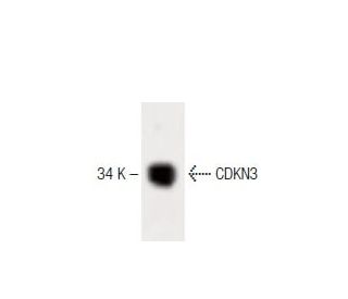 CDKN3 Antibody (39) - Western Blotting - Image 60182 