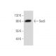 Sec6 Antibody (B-10) - Western Blotting - Image 134743