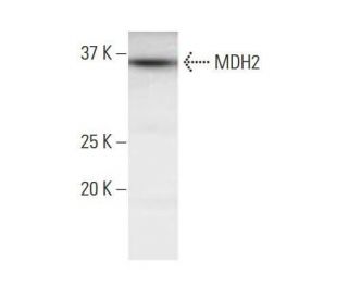 MDH2 Antibody (1G12) - Western Blotting - Image 352124Each CRISPR/Cas9 Knockout (KO) Plasmid product consists of a pool of 3 plasmids designed to ensure identification and cleavage of a specific gene for maximum knockout efficiency. Each plasmid encodes a unique 20 nt sequence derived from the GeCKO (v2) library.