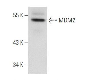 MDM2 Antibody (HDM2-323) - Western Blotting - Image 54445 