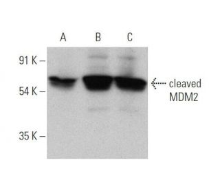 MDM2 Antibody (SMP14) - Western Blotting - Image 353053Each CRISPR/Cas9 Knockout (KO) Plasmid product consists of a pool of 3 plasmids designed to ensure identification and cleavage of a specific gene for maximum knockout efficiency. Each plasmid encodes a unique 20 nt sequence derived from the GeCKO (v2) library.