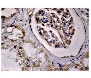 MDMX Antibody (D-2) - Immunohistochemistry - Image 260792 