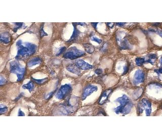 MDR1/ABCB1 Antibody (G-1) - Immunohistochemistry - Image 3167 