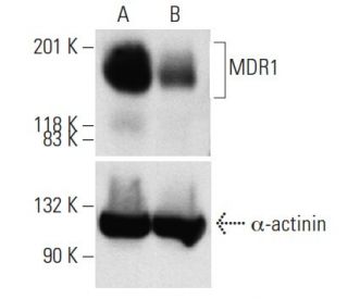 MDR1 siRNA (h): sc-29395. Western blot analysis of MDR1 expression in non-transfected control (A) and MDR1 siRNA transfect 