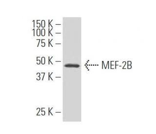 MEF-2B Antibody (4B5) - Western Blotting - Image 370716
