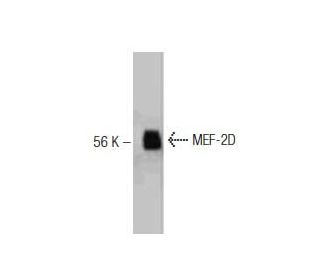 MEF-2D Antibody (9) - Western Blotting - Image 127517 