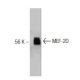 MEF-2D Antibody (9) - Western Blotting - Image 127517 