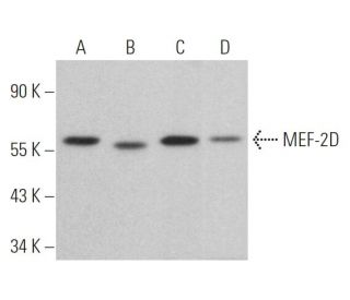 MEF-2D Antibody (H-11) - Western Blotting - Image 362822Each CRISPR/Cas9 Knockout (KO) Plasmid product consists of a pool of 3 plasmids designed to ensure identification and cleavage of a specific gene for maximum knockout efficiency. Each plasmid encodes a unique 20 nt sequence derived from the GeCKO (v2) library.
