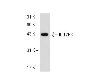 IL-17RB Antibody (97C691) - Western Blotting - Image 55371 