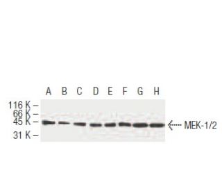 MEK-1/2 Antibody (9G3) - Western Blotting - Image 62932 
