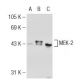 MEK-2 Antibody (96) - Western Blotting - Image 125911 