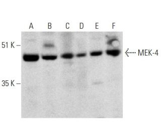 MEK-4 Antibody (G-7) - Western Blotting - Image 324765