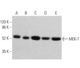MEK-7 Antibody (E-7) - Western Blotting - Image 359707 