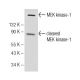 MEK kinase-1 Antibody (1-9C-2A) - Western Blotting - Image 1846