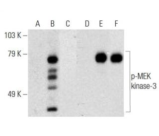 MEK kinase-3 Antibody (40) - Western Blotting - Image 145554 