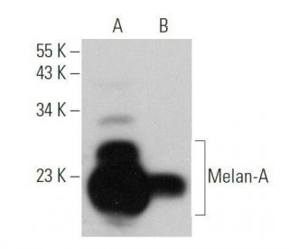 Melan-A Antibody (0.N.396) - Western Blotting - Image 355298 