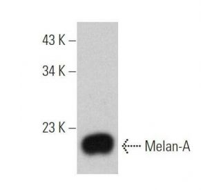 Melan-A Antibody (0.N.397) - Western Blotting - Image 355297 