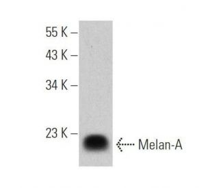Melan-A Antibody (3H2639) - Western Blotting - Image 355295 