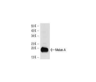 Melan-A Antibody (M2-7C10) - Western Blotting - Image 14354 
