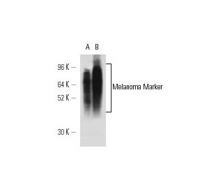 Melanoma Marker Antibody (NKI/C3) - Western Blotting - Image 12592 
