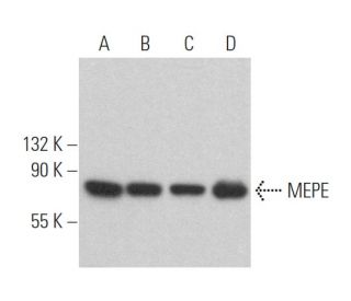 MEPE Antibody (LFMb-33) - Western Blotting - Image 364163 