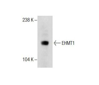 EHMT1 (V-19): sc-68166. Western blot analysis of EHMT1 expression in MES-SA/Dx5 whole cell lysate. 