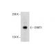 EHMT1 (V-19): sc-68166. Western blot analysis of EHMT1 expression in MES-SA/Dx5 whole cell lysate. 