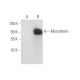 Mesothelin Antibody (B-3) - Western Blotting - Image 68289