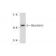 Mesothelin Antibody (B-3) - Western Blotting - Image 325121 