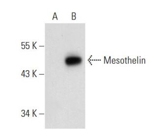 Mesothelin Antibody (K1) - Western Blotting - Image 74526