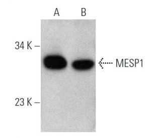 MESP1 Antibody (JH.12) - Western Blotting - Image 368189 