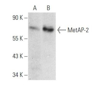 MetAP-2 Antibody (D-1) - Western Blotting - Image 358476 
