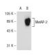 MetAP-2 Antibody (G-5) - Western Blotting - Image 109096