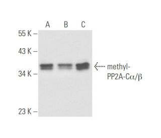 methyl-PP2A-C&alpha;/&beta; Antibody (2A10) - Western Blotting - Image 57847 