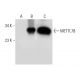 METTL7B Antibody (D-2) - Western Blotting - Image 306612 