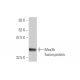 Mex3b Antibody (4C4) - Western Blotting - Image 350286