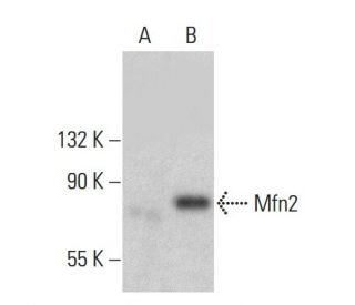 Mfn2/Mitofusin 2 Antibody (F-5) - Western Blotting - Image 380984